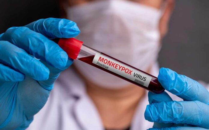 A healthcare professional holding a test tube labeled MONKEYPOX VIRUS Positive