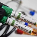 Two blood test tubes labeled HDL and LDL cholesterol