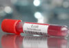 A laboratory vial labeled E. coli containing a blood sample