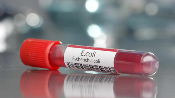 A laboratory vial labeled E. coli containing a blood sample