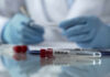 Ebola test tubes on lab table with gloved scientist in background