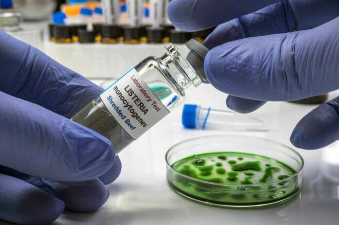 Expert,Analyzes,Stuffed,Meat,Contaminated,By,Bacterium,Of,Listeria,In A laboratory technician holding a vial labeled 'Listeria monocytogenes' above a petri dish with green culture