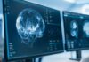Screens displaying brain scans and data in a medical setting