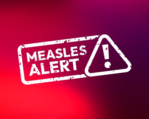 Measles,Alert,Warning,Sign,,Grunge,Stamp Measles alert warning sign with exclamation mark